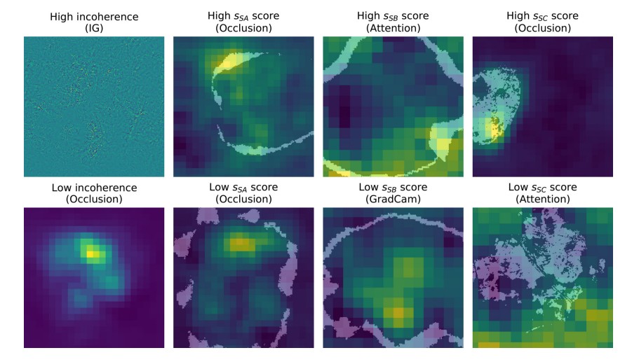 Saliency map comparison grid for melanoma